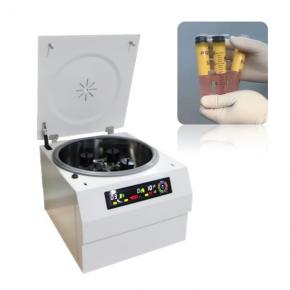 FAT02 Fat Liposuction Centrifuge